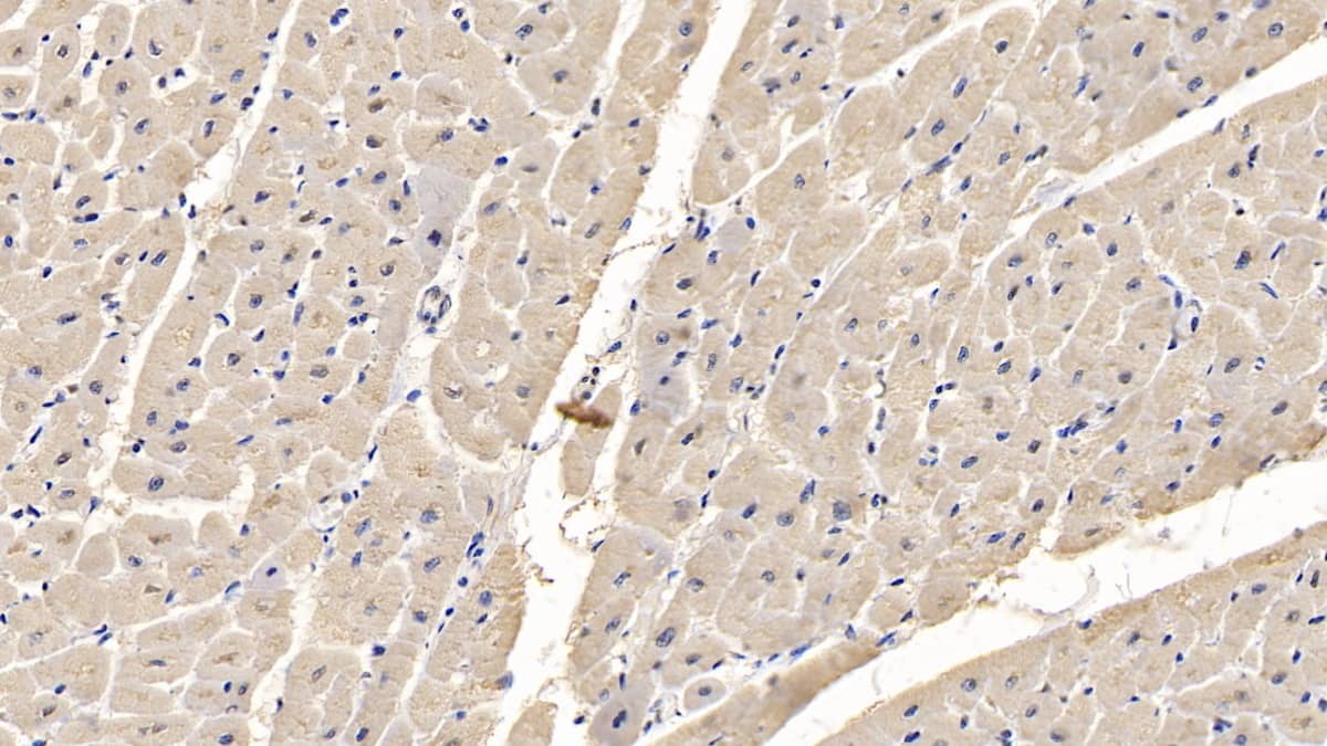 Immunohistochemistry-Paraffin MYH4 Antibody (C3)