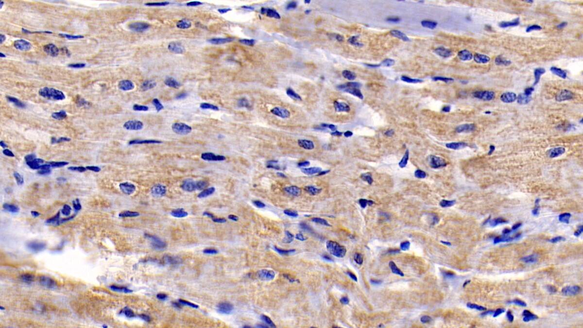Immunohistochemistry-Paraffin: BAI3 Antibody (C6) [NBP3-41752] - DAB staining on IHC-P; Sample: Human Cardiac Muscle Tissue; Primary Ab: 30ug/ml NBP3-41752; Second Ab: 2ug/mL HRP-Linked Caprine Anti-Mouse IgG Polyclonal Antibody