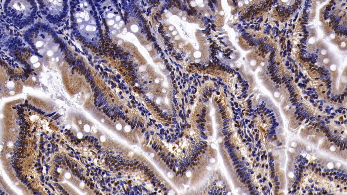 Immunohistochemistry-Paraffin: SAE2 Antibody [NBP3-41754] - DAB staining on IHC-P; Sample: Rat Small intestine Tissue; Primary Ab: 20ug/ml NBP3-41754; Second Ab: 2ug/mL HRP-Linked Caprine Anti-Rabbit IgG Polyclonal Antibody