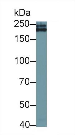 Western Blot: Collagen IV alpha3 Antibody (D2) [NBP3-41756] - Sample: Rat Kidney lysate Primary Ab: 1.5ug/ml NBP3-41756; Second Ab: 0.2ug/mL HRP-Linked Caprine Anti-Mouse IgG Polyclonal Antibody