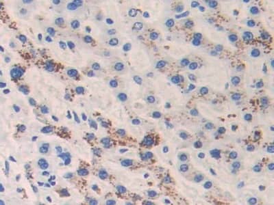 Immunohistochemistry-Paraffin: CAMP/Cathelicidin Antibody (C1) [NBP3-41757] - DAB staining on IHC-P; Samples: Human Liver Tissue; Primary Ab: 30ug/ml NBP3-41757; Second Ab: 2ug/mL HRP-Linked Caprine Anti-Mouse IgG Polyclonal Antibody