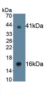 Western Blot: epithelial Sodium Channel gamma Antibody (C1) [NBP3-41759] - Sample: Recombinant epithelial Sodium Channel gamma, Human.