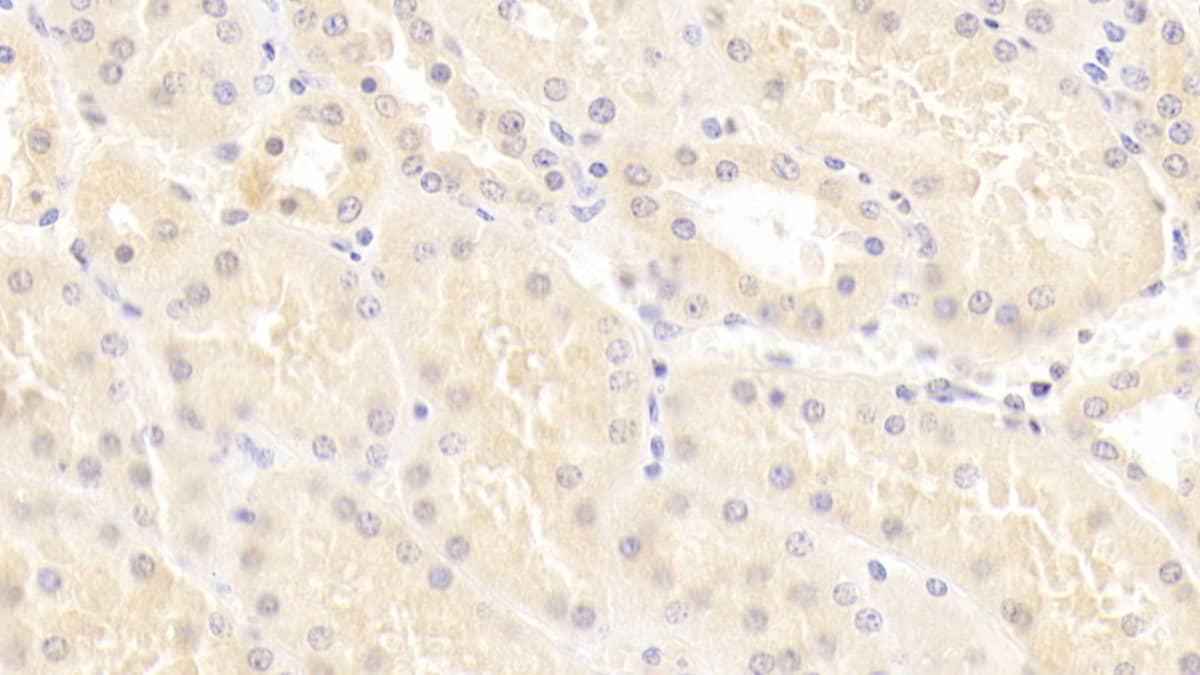 Immunohistochemistry-Paraffin: epithelial Sodium Channel gamma Antibody (C1) [NBP3-41759] - DAB staining on IHC-P; Sample: Human Kidney Tissue; Primary Ab: 20ug/ml NBP3-41759; Second Ab: 2ug/mL HRP-Linked Caprine Anti-Mouse IgG Polyclonal Antibody