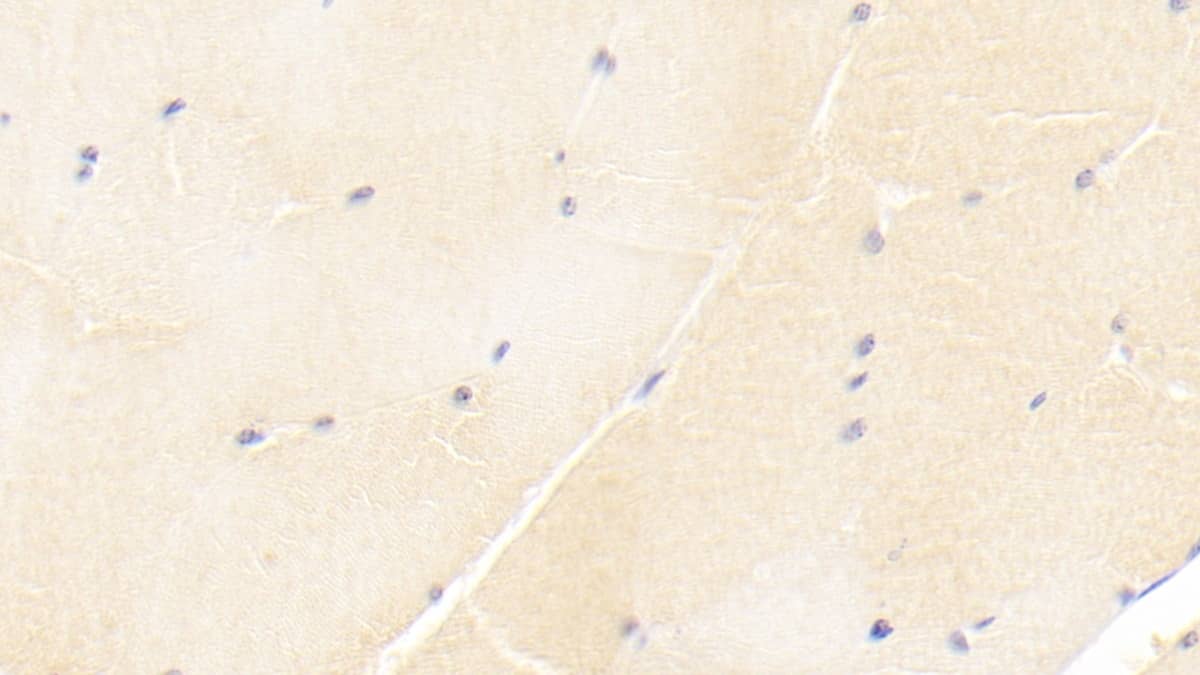 Immunohistochemistry-Paraffin: ISLR Antibody (C3) [NBP3-41760] - DAB staining on IHC-P; Sample: Human Skeletal muscle Tissue; Primary Ab: 20ug/ml NBP3-41760; Second Ab: 2ug/mL HRP-Linked Caprine Anti-Mouse IgG Polyclonal Antibody