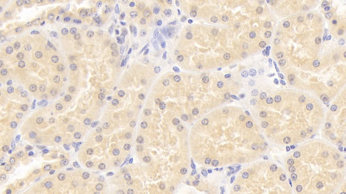 Immunohistochemistry-Paraffin: ISLR Antibody (C3) [NBP3-41760] - DAB staining on IHC-P; Sample: Human Kidney Tissue; Primary Ab: 20ug/ml NBP3-41760; Second Ab: 2ug/mL HRP-Linked Caprine Anti-Mouse IgG Polyclonal Antibody