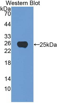 Western Blot: Noggin Antibody (A7) [NBP3-41763] - Sample: Recombinant Noggin, Human.