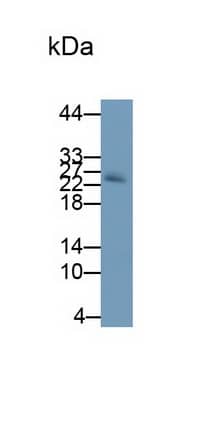 Western Blot: Noggin Antibody (A11) [NBP3-41764] - Sample: Rat Placenta lysate Primary Ab: 1ug/ml NBP3-41764; Second Ab: 0.2ug/mL HRP-Linked Caprine Anti-Mouse IgG Polyclonal Antibody