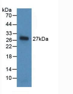 Western Blot: Noggin Antibody (A11) [NBP3-41764] - Sample: Recombinant Noggin, Human.