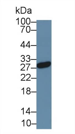 Western Blot: Noggin Antibody (A9) [NBP3-41765] - Sample: Rat Placenta lysate; Primary Ab: 2ug/ml NBP3-41765; Second Ab: 0.2ug/mL HRP-Linked Caprine Anti-Mouse IgG Polyclonal Antibody