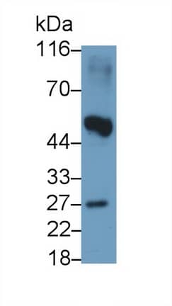 Western Blot: Noggin Antibody (A9) [NBP3-41765] - Sample: Mouse Placenta lysate Primary Ab: 1ug/ml NBP3-41765; Second Ab: 0.2ug/mL HRP-Linked Caprine Anti-Mouse IgG Polyclonal Antibody