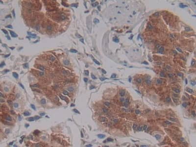 Immunohistochemistry-Paraffin Lefty-1 Antibody (C10)