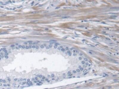 Immunohistochemistry-Paraffin: Fibulin 1 Antibody (D1) [NBP3-41767] - DAB staining on IHC-P; Samples: Human Prostate Tissue; Primary Ab: 30ug/ml NBP3-41767