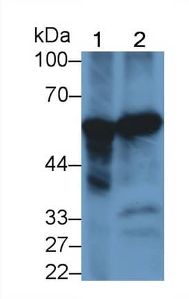 Western Blot: Phenylalanine Hydroxylase Antibody (C3) [NBP3-41772] - Sample: Lane1: Rat Liver lysate; Lane2: Mouse Gallbladder lysate Primary Ab: 2ug/ml NBP3-41772; Second Ab: 0.2ug/mL HRP-Linked Caprine Anti-Mouse IgG Polyclonal Antibody