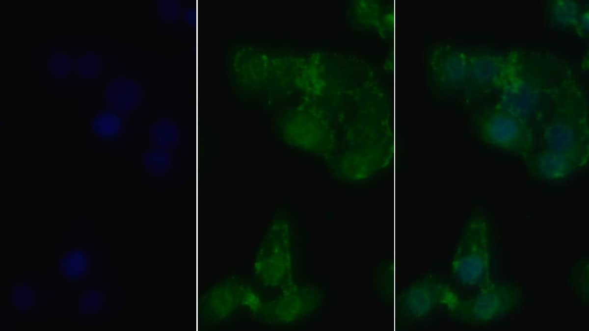 Immunocytochemistry /Immunofluorescence: RIPK1/RIP1 Antibody (C1) [NBP3-41774] - FITC staining on IF; Sample: Human Hela cell; Primary Ab: 20ug/ml NBP3-41774; Second Ab: 4ug/ml FITC-Linked Caprine Anti-Mouse IgG Polyclonal Antibody