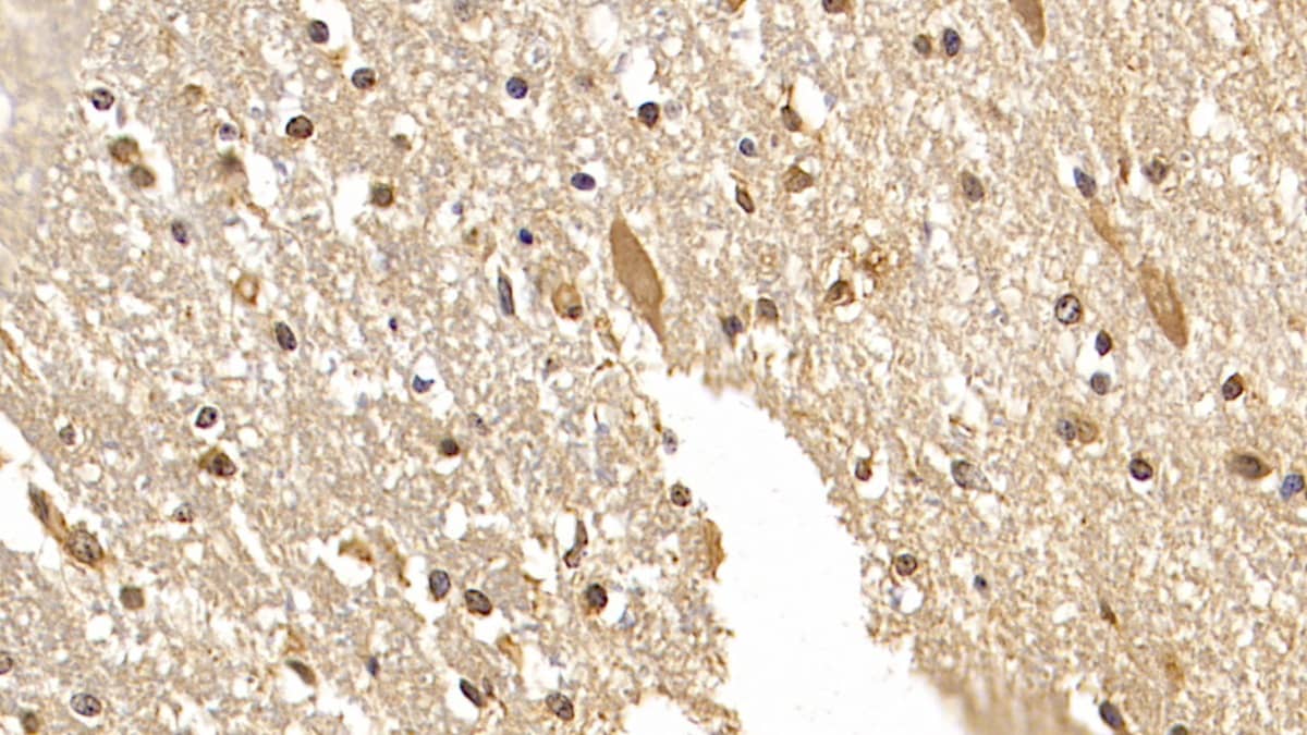 Immunohistochemistry-Paraffin: DCLK1 Antibody (C8) [NBP3-41776] - DAB staining on IHC-P; Samples: Human Cerebrum Tissue; Primary Ab: 20ug/ml NBP3-41776; Second Ab: 2ug/mL HRP-Linked Caprine Anti-Mouse IgG Polyclonal Antibody