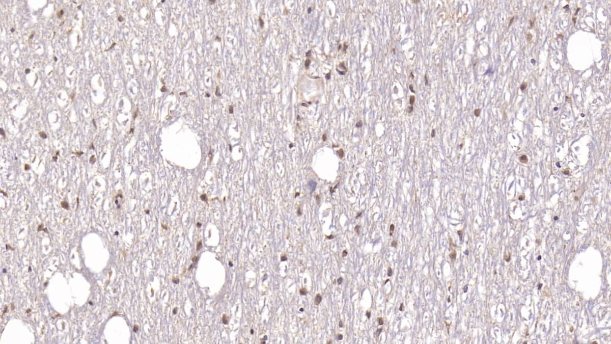 Immunohistochemistry-Paraffin: DCLK1 Antibody (C8) [NBP3-41776] - DAB staining on IHC-P; Samples: Human Cerebellum Tissue; Primary Ab: 20ug/ml NBP3-41776; Second Ab: 2ug/mL HRP-Linked Caprine Anti-Mouse IgG Polyclonal Antibody