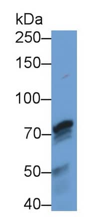 Western Blot: PADI4 Antibody (C5) [NBP3-41777] - Sample: Human Saliva Primary Ab: 3ug/ml NBP3-41777; Second Ab: 0.2ug/mL HRP-Linked Caprine Anti-Mouse IgG Polyclonal Antibody