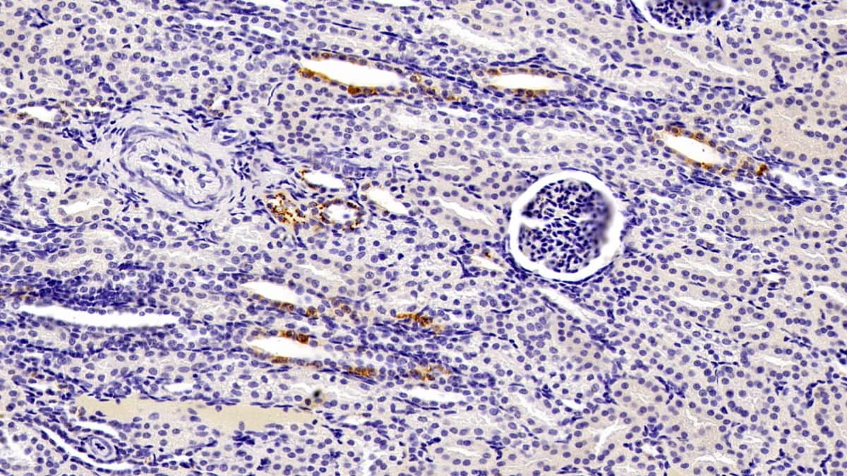 Immunohistochemistry-Paraffin: SeP Antibody (H1) [NBP3-41780] - DAB staining on IHC-P; Sample: Human Kidney Tissue; Primary Ab: 20ug/ml NBP3-41780; Second Ab: 2ug/mL HRP-Linked Caprine Anti-Mouse IgG Polyclonal Antibody