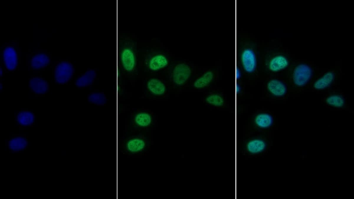 Immunocytochemistry /Immunofluorescence: CEBP alpha Antibody (C9) [NBP3-41783] - FITC staining on IF; Sample: Human Hela cell; Primary Ab: 30ug/ml NBP3-41783; Second Ab: 2ug/ml FITC-Linked Caprine Anti-Mouse IgG Polyclonal Antibody