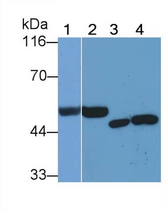 Western Blot: Heparanase/HPSE Antibody (C5) [NBP3-41785] - Sample: Lane1: Rat Serum; Lane2: Rat Placenta lysate; Lane3: HepG2 cell lysate; Lane4: Jurkat cell lysate Primary Ab: 0.5ug/ml NBP3-41785; Second Ab: 0.2ug/mL HRP-Linked Caprine Anti-Mouse IgG Polyclonal Antibody