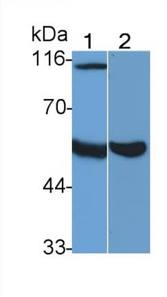 Western Blot: Heparanase/HPSE Antibody (C6) [NBP3-41786] - Sample: Lane1: Rat Serum; Lane2: Rat Placenta lysate Primary Ab: 0.5ug/ml NBP3-41786; Second Ab: 0.2ug/mL HRP-Linked Caprine Anti-Mouse IgG Polyclonal Antibody