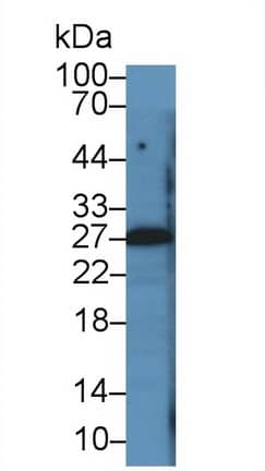 Western Blot: PTHLH/PTHrP Antibody (D1) [NBP3-41787] - Sample: A549 cell lysate Primary Ab: 2ug/ml NBP3-41787; Second Ab: 0.2ug/mL HRP-Linked Caprine Anti-Mouse IgG Polyclonal Antibody