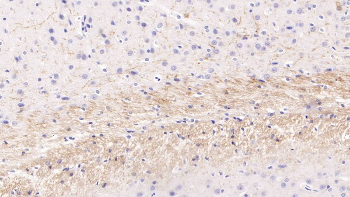 Immunohistochemistry-Paraffin: PTHLH/PTHrP Antibody (D4) [NBP3-41793] - DAB staining on IHC-P; Sample: Rat Cerebrum Tissue; Primary Ab: 10ug/ml NBP3-41793; Second Ab: 2ug/mL HRP-Linked Caprine Anti-Mouse IgG Polyclonal Antibody