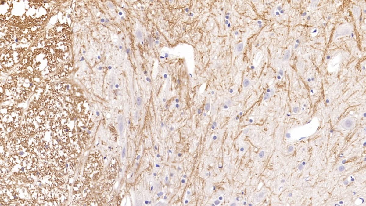 Immunohistochemistry-Paraffin PTHLH/PTHrP Antibody (D4)