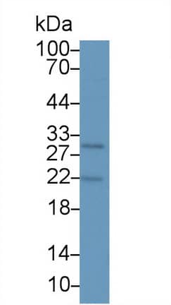 Western Blot: PTHLH/PTHrP Antibody (D4) [NBP3-41793] - Sample: A549 cell lysate; Primary Ab: 2ug/ml NBP3-41793; Second Ab: 0.2ug/mL HRP-Linked Caprine Anti-Mouse IgG Polyclonal Antibody