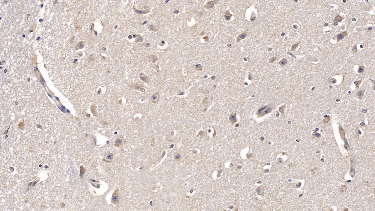 Immunohistochemistry-Paraffin: FGF-13 Antibody (C2) [NBP3-41796] - DAB staining on IHC-P; Samples: Human Cerebrum Tissue; Primary Ab: 10ug/ml NBP3-41796; Second Ab: 2ug/mL HRP-Linked Caprine Anti-Mouse IgG Polyclonal Antibody