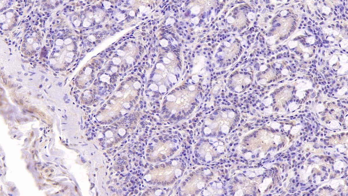 Immunohistochemistry-Paraffin: DNAH11 Antibody (C2) [NBP3-41797] - DAB staining on IHC-P; Samples: Human Small intestine Tissue; Primary Ab: 40ug/ml NBP3-41797; Second Ab: 2ug/mL HRP-Linked Caprine Anti-Mouse IgG Polyclonal Antibody