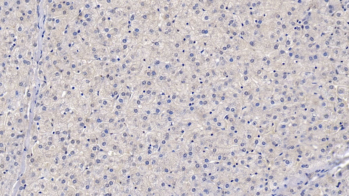 Immunohistochemistry-Paraffin: Apolipoprotein B100/ApoB100 Antibody (D10) [NBP3-41798] - DAB staining on IHC-P; Sample: Human Liver Tissue; Primary Ab: 10ug/ml NBP3-41798; Second Ab: 2ug/mL HRP-Linked Caprine Anti-Mouse IgG Polyclonal Antibody