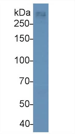 Western Blot: Apolipoprotein B100/ApoB100 Antibody (D10) [NBP3-41798] - Sample: Human Serum Primary Ab: 3ug/ml NBP3-41798; Second Ab: 0.2ug/mL HRP-Linked Caprine Anti-Mouse IgG Polyclonal Antibody