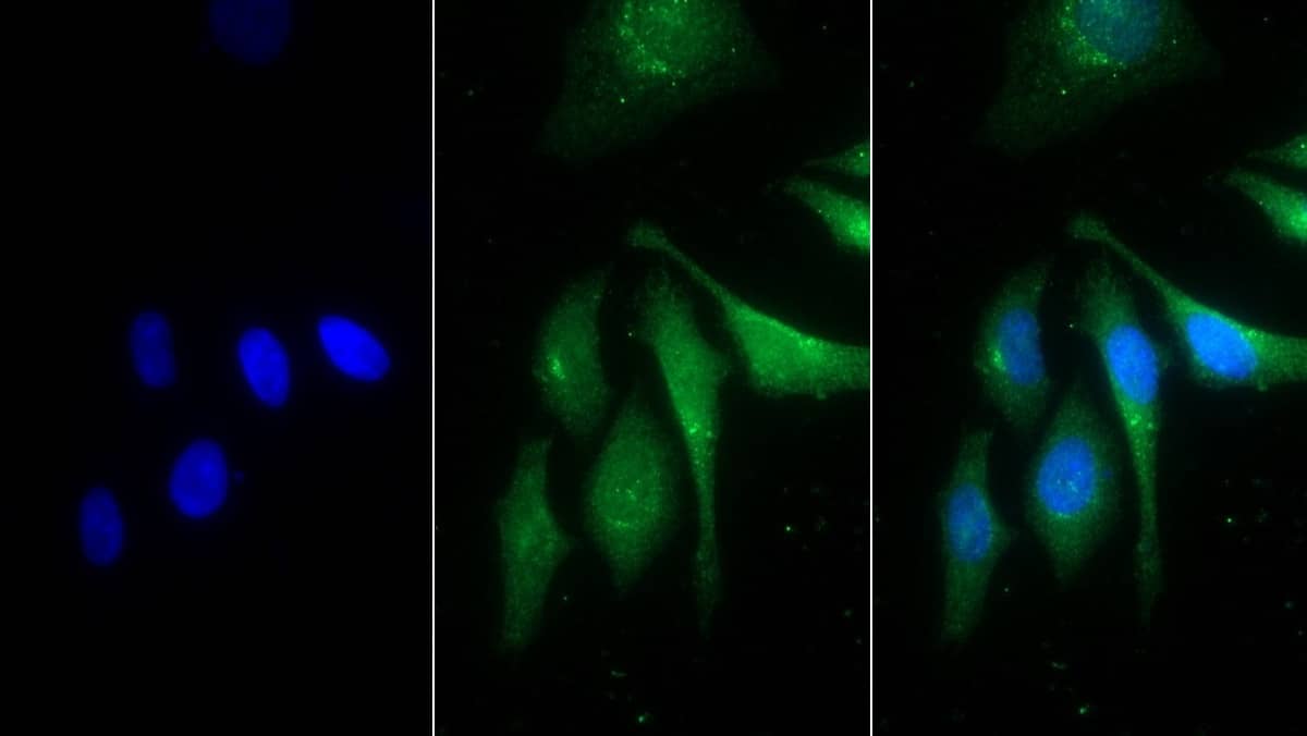 Immunocytochemistry /Immunofluorescence: PSAP Antibody (D4) [NBP3-41801] - FITC staining on IF; Sample: Human HepG2 cell; Primary Ab: 30ug/ml NBP3-41801; Second Ab: 2ug/ml FITC-Linked Caprine Anti-Mouse IgG Polyclonal Antibody