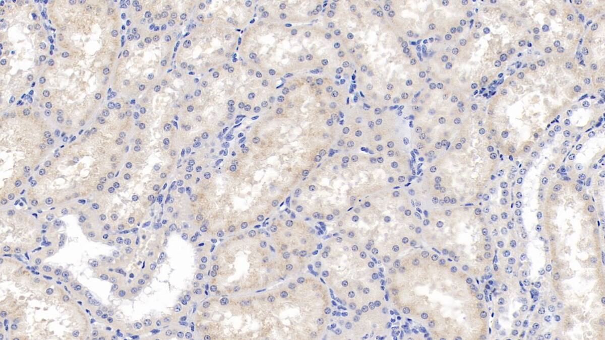 Immunohistochemistry-Paraffin: Eosinophil derived neurotoxin Antibody (C11) [NBP3-41802] - DAB staining on IHC-P; Samples: Human Kidney Tissue; Primary Ab: 30ug/ml NBP3-41802; Second Ab: 2ug/mL HRP-Linked Caprine Anti-Mouse IgG Polyclonal Antibody