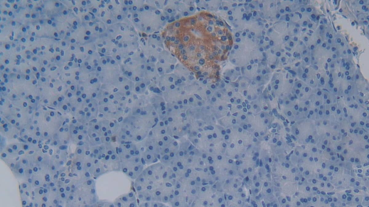 Immunohistochemistry-Paraffin: Lefty-1 Antibody (C8) [NBP3-41811] - DAB staining on IHC-P; Samples: Human Pancreas Tissue; Primary Ab: 30ug/ml NBP3-41811; Second Ab: 2ug/mL HRP-Linked Caprine Anti-Mouse IgG Polyclonal Antibody