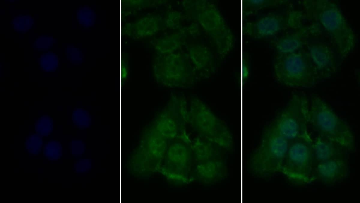 Immunocytochemistry /Immunofluorescence: RIPK1/RIP1 Antibody (C2) [NBP3-41815] - FITC staining on IF; Sample: Human Hela cell; Primary Ab: 20ug/ml NBP3-41815; Second Ab: 4ug/ml FITC-Linked Caprine Anti-Mouse IgG Polyclonal Antibody