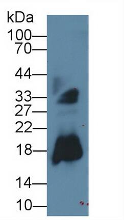 Western Blot: Eosinophil derived neurotoxin Antibody (C10) [NBP3-41817] - Sample: Human Urine; Primary Ab: 2ug/ml NBP3-41817; Second Ab: 0.2ug/mL HRP-Linked Rabbit Anti-Mouse IgG Polyclonal Antibody