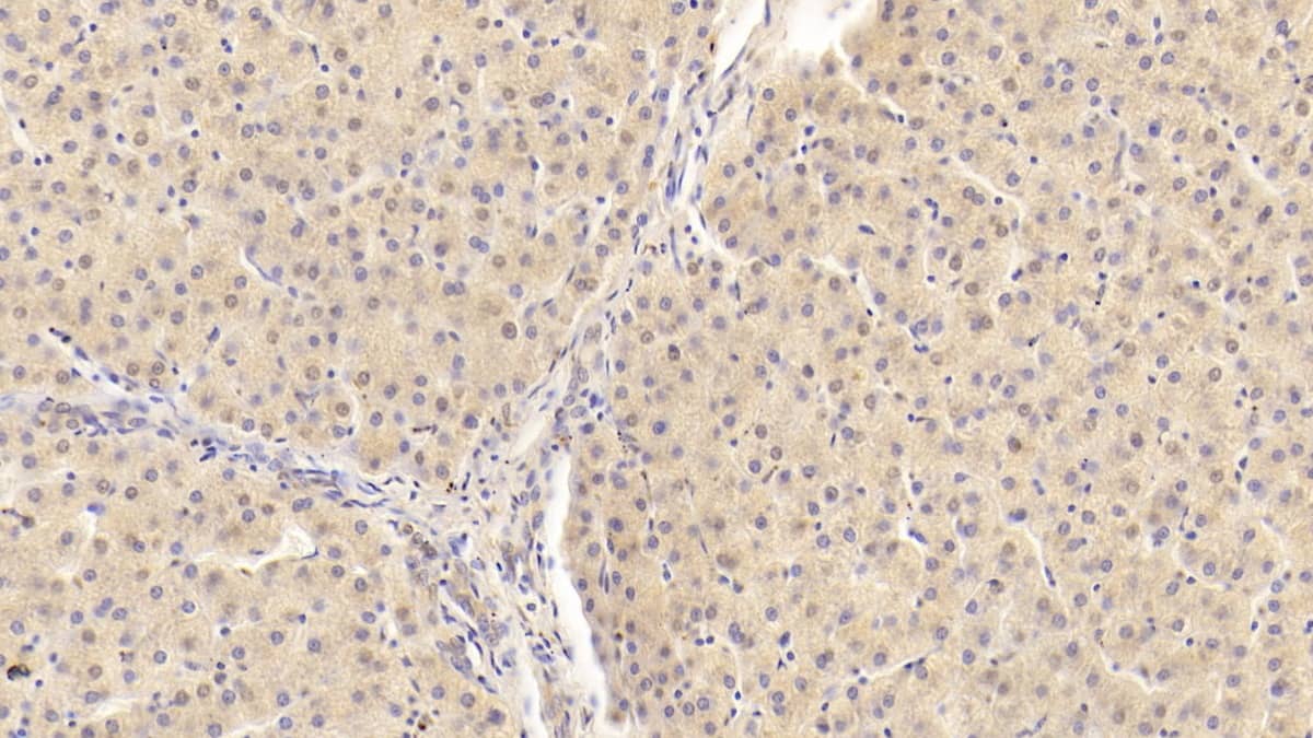 Immunohistochemistry-Paraffin: Apolipoprotein B100/ApoB100 Antibody (D8) [NBP3-41819] - DAB staining on IHC-P; Sample: Human Liver Tissue; Primary Ab: 30ug/ml NBP3-41819; Second Ab: 2ug/mL HRP-Linked Caprine Anti-Mouse IgG Polyclonal Antibody