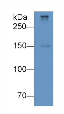 Western Blot: Apolipoprotein B100/ApoB100 Antibody (D8) [NBP3-41819] - Sample: Human Serum Primary Ab: 3ug/ml NBP3-41819; Second Ab: 0.2ug/mL HRP-Linked Caprine Anti-Mouse IgG Polyclonal Antibody