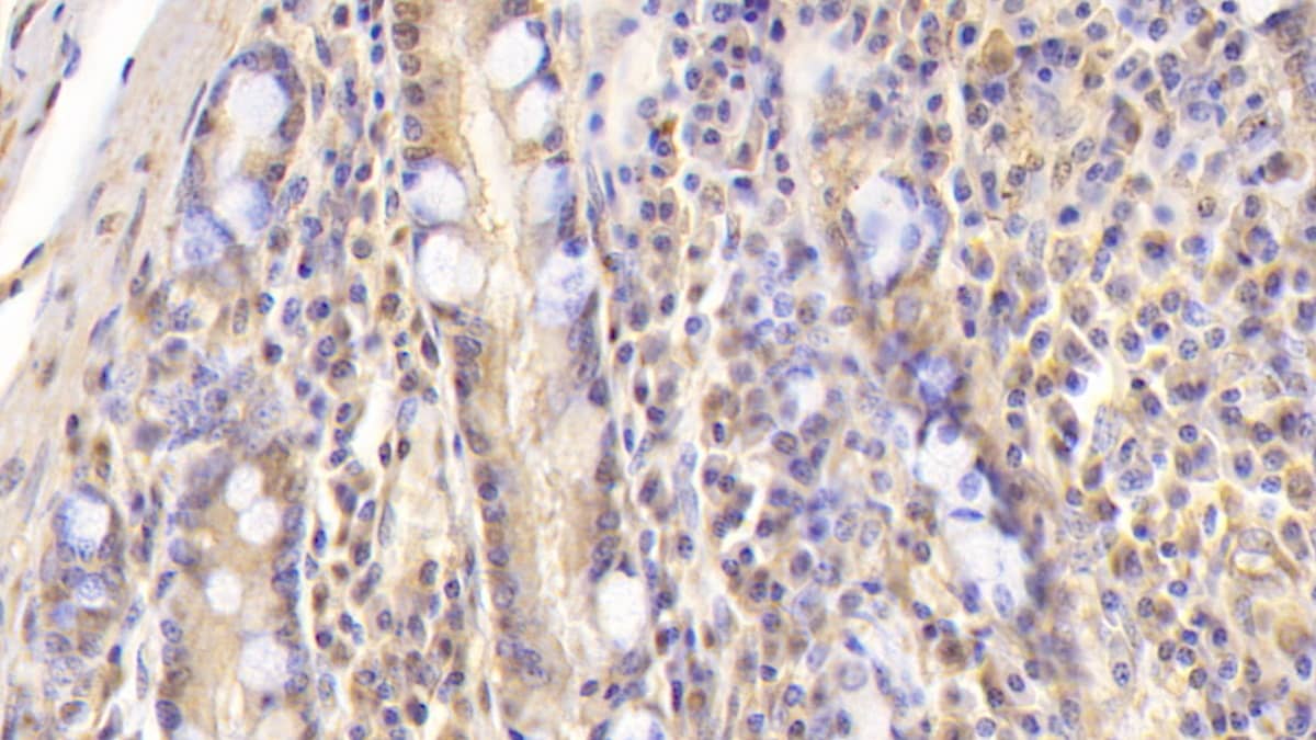 Immunohistochemistry-Paraffin: Apolipoprotein B100/ApoB100 Antibody (D8) [NBP3-41819] - DAB staining on IHC-P; Sample: Human Small intestine Tissue; Primary Ab: 30ug/ml NBP3-41819; Second Ab: 2ug/mL HRP-Linked Caprine Anti-Mouse IgG Polyclonal Antibody