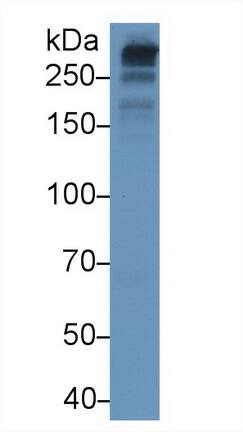 Western Blot: Apolipoprotein B100/ApoB100 Antibody (D5) [NBP3-41820] - Sample: Human Serum Primary Ab: 3ug/ml NBP3-41820; Second Ab: 0.2ug/mL HRP-Linked Caprine Anti-Mouse IgG Polyclonal Antibody
