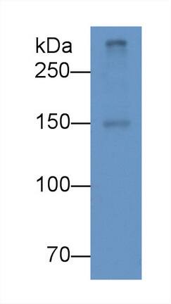 Western Blot: Apolipoprotein B100/ApoB100 Antibody (D3) [NBP3-41822] - Sample: Human Serum Primary Ab: 3ug/ml NBP3-41822; Second Ab: 0.2ug/mL HRP-Linked Caprine Anti-Mouse IgG Polyclonal Antibody
