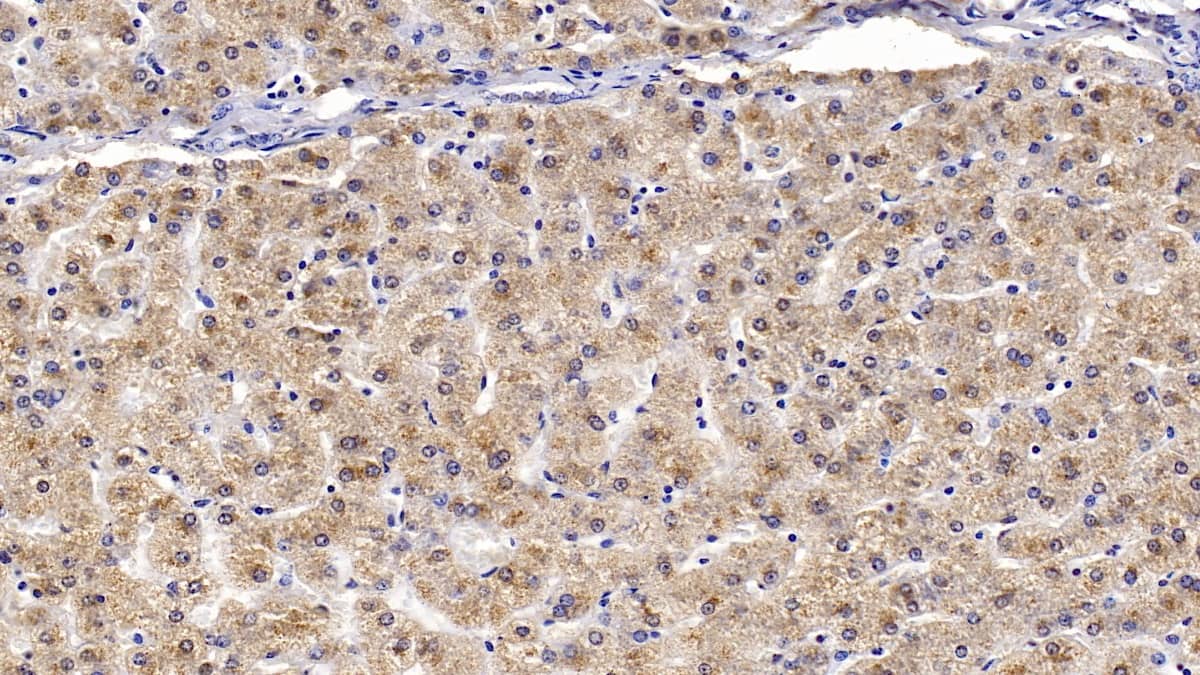 Immunohistochemistry-Paraffin: Apolipoprotein B100/ApoB100 Antibody (C2) [NBP3-41823] - DAB staining on IHC-P; Samples: Human Liver Tissue; Primary Ab: 10ug/ml NBP3-41823; Second Ab: 2ug/mL HRP-Linked Caprine Anti-Mouse IgG Polyclonal Antibody