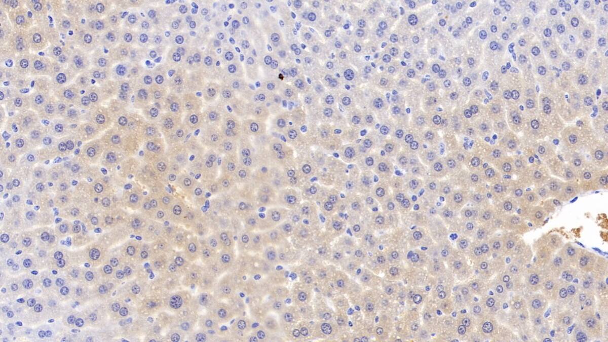 Immunohistochemistry-Paraffin: Apolipoprotein C1 Antibody (C6) [NBP3-41825] - DAB staining on IHC-P; Sample: Mouse Liver Tissue; Primary Ab: 20ug/ml NBP3-41825; Second Ab: 2ug/mL HRP-Linked Caprine Anti-Mouse IgG Polyclonal Antibody