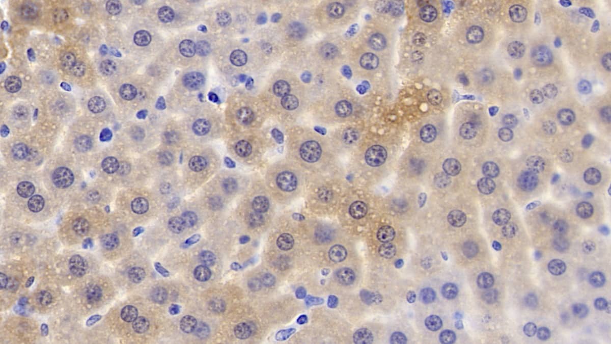 Immunohistochemistry-Paraffin: Apolipoprotein C1 Antibody (C8) [NBP3-41826] - DAB staining on IHC-P; Sample: Mouse Liver Tissue; Primary Ab: 20ug/ml NBP3-41826; Second Ab: 2ug/mL HRP-Linked Caprine Anti-Mouse IgG Polyclonal Antibody