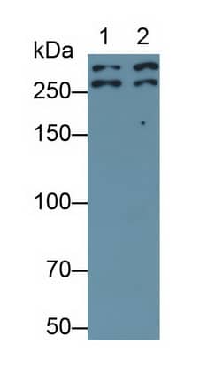 Western Blot: Desmoplakin Antibody (C1) [NBP3-41829] - Sample: Lane1: HaCaT cell lysate; Lane2: Hela cell lysate Primary Ab: 0.2ug/ml NBP3-41829; Second Ab: 0.2ug/mL HRP-Linked Caprine Anti-Mouse IgG Polyclonal Antibody