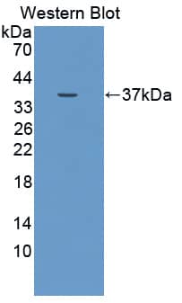 Western Blot: DUOX2 Antibody [NBP3-41830] - Sample: Recombinant protein.