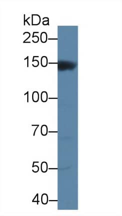 Western Blot: MAP3K6 Antibody [NBP3-41831] - Sample: Rat Serum; Primary Ab: 2ug/ml NBP3-41831; Second Ab: 0.2ug/mL HRP-Linked Caprine Anti-Rabbit IgG Polyclonal Antibody