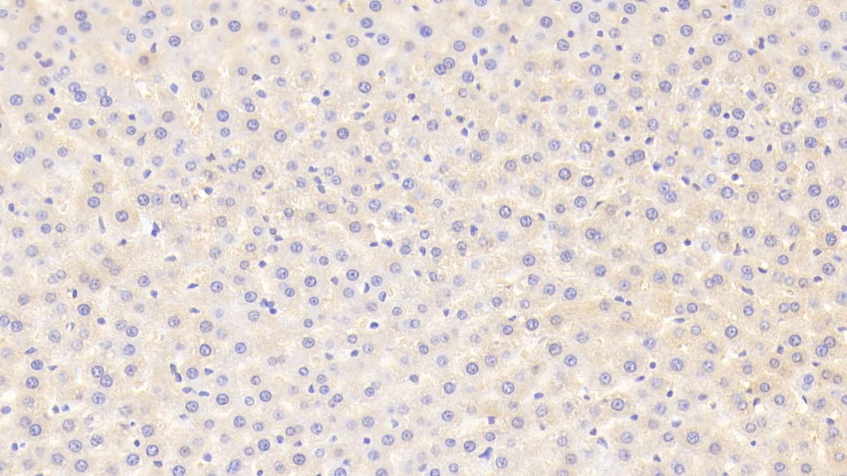 Immunohistochemistry-Paraffin: MAP3K6 Antibody [NBP3-41831] - DAB staining on IHC-P; Samples: Rat Liver Tissue; Primary Ab: 20ug/ml NBP3-41831; Second Ab: 2ug/mL HRP-Linked Caprine Anti-Rabbit IgG Polyclonal Antibody